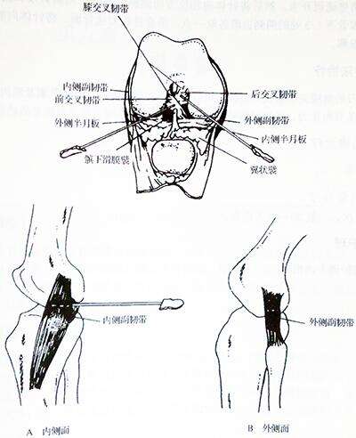 小针刀治疗膝关节炎图解