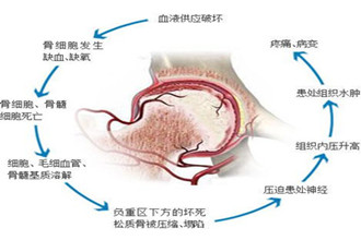 病变原理.jpg